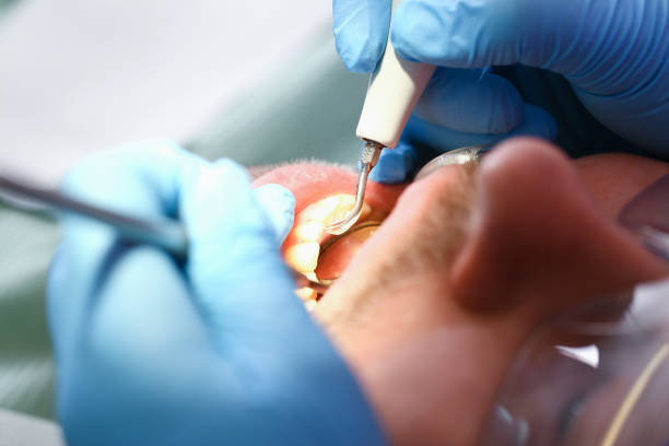 Best Emergency Dental Surgery in Cuero, TX