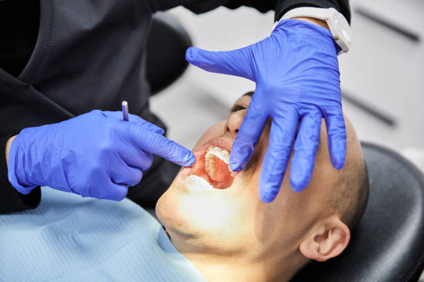 Best Emergency Tooth Extraction in Cuero, TX